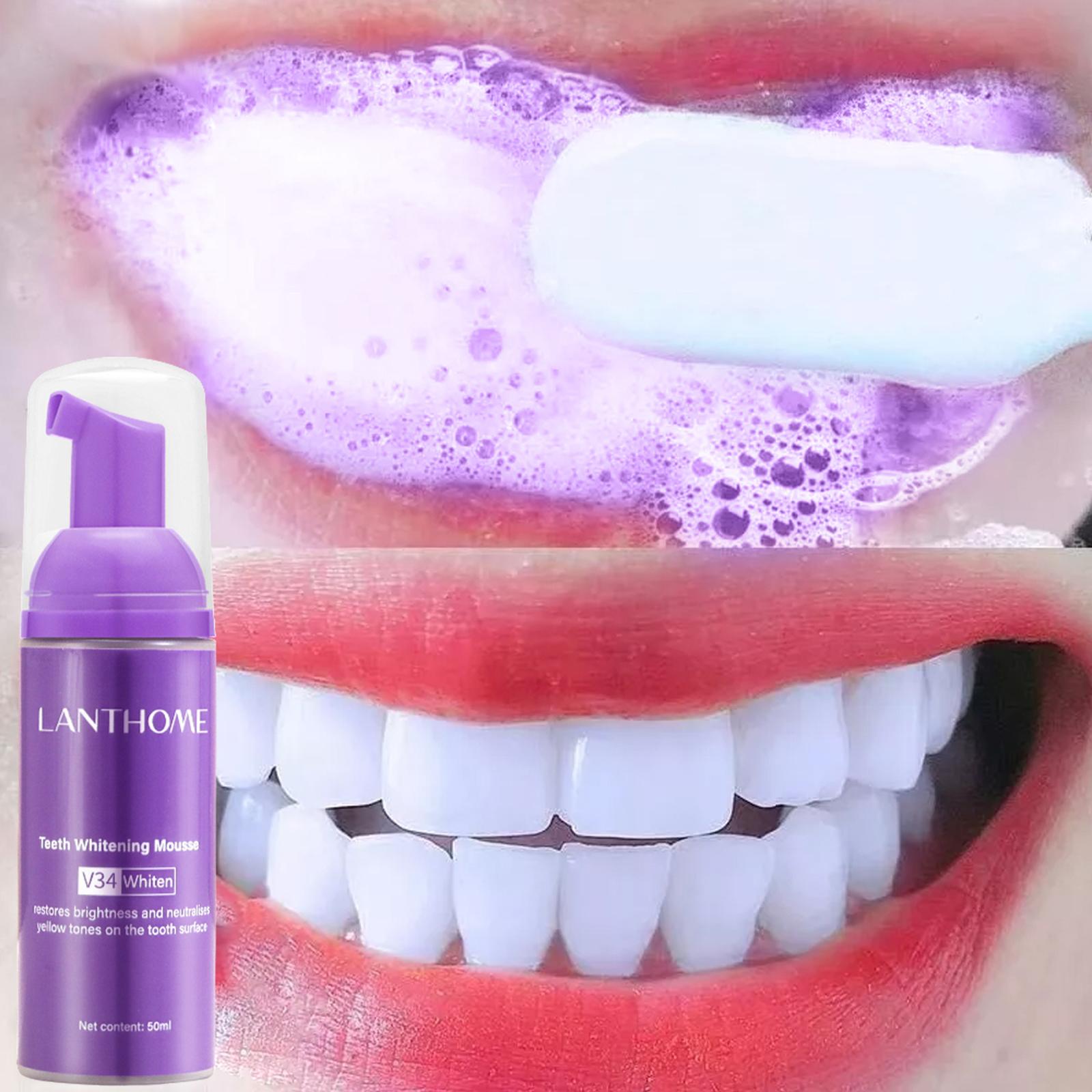 Teeth Whitening Crest - V34 Mousse Dentifricio per la pulizia