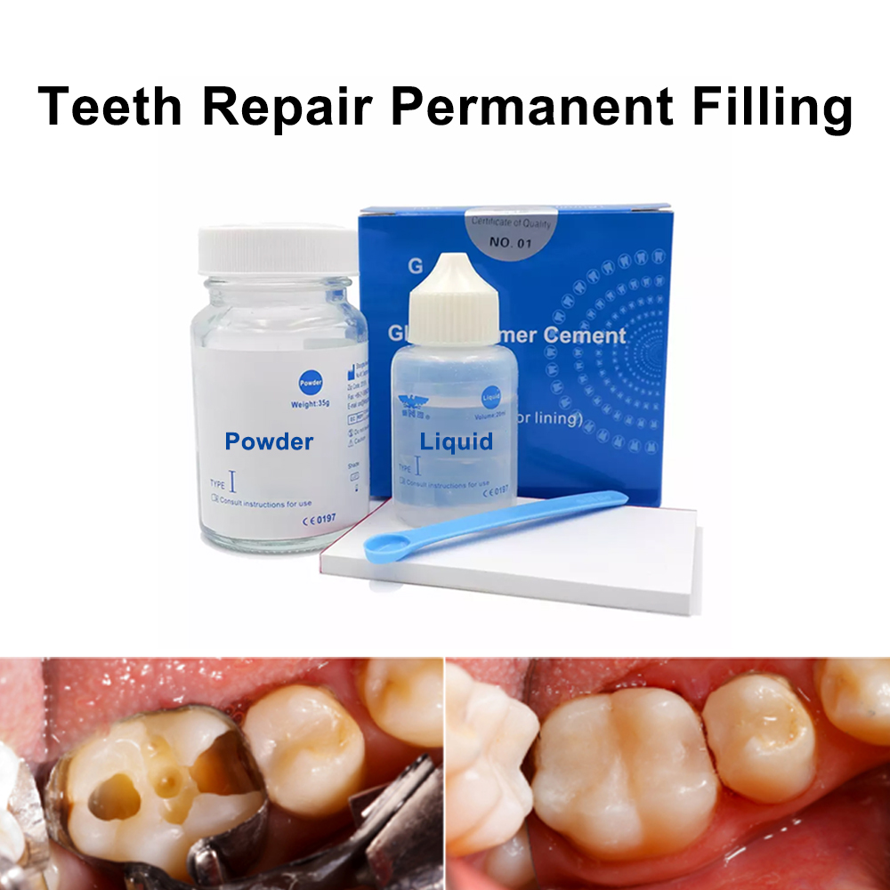 Teeth Whitening Kit At Home - Kit di riparazione per riempimento dentale