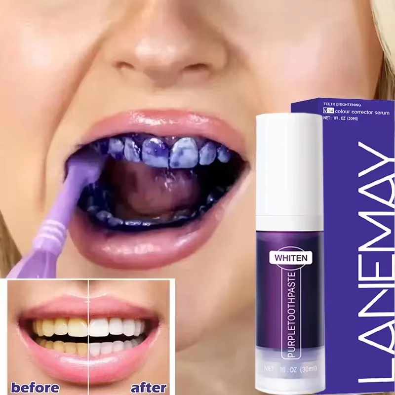 Teeth Whitening Crest - V34 Dentifricio sbiancante per denti viola