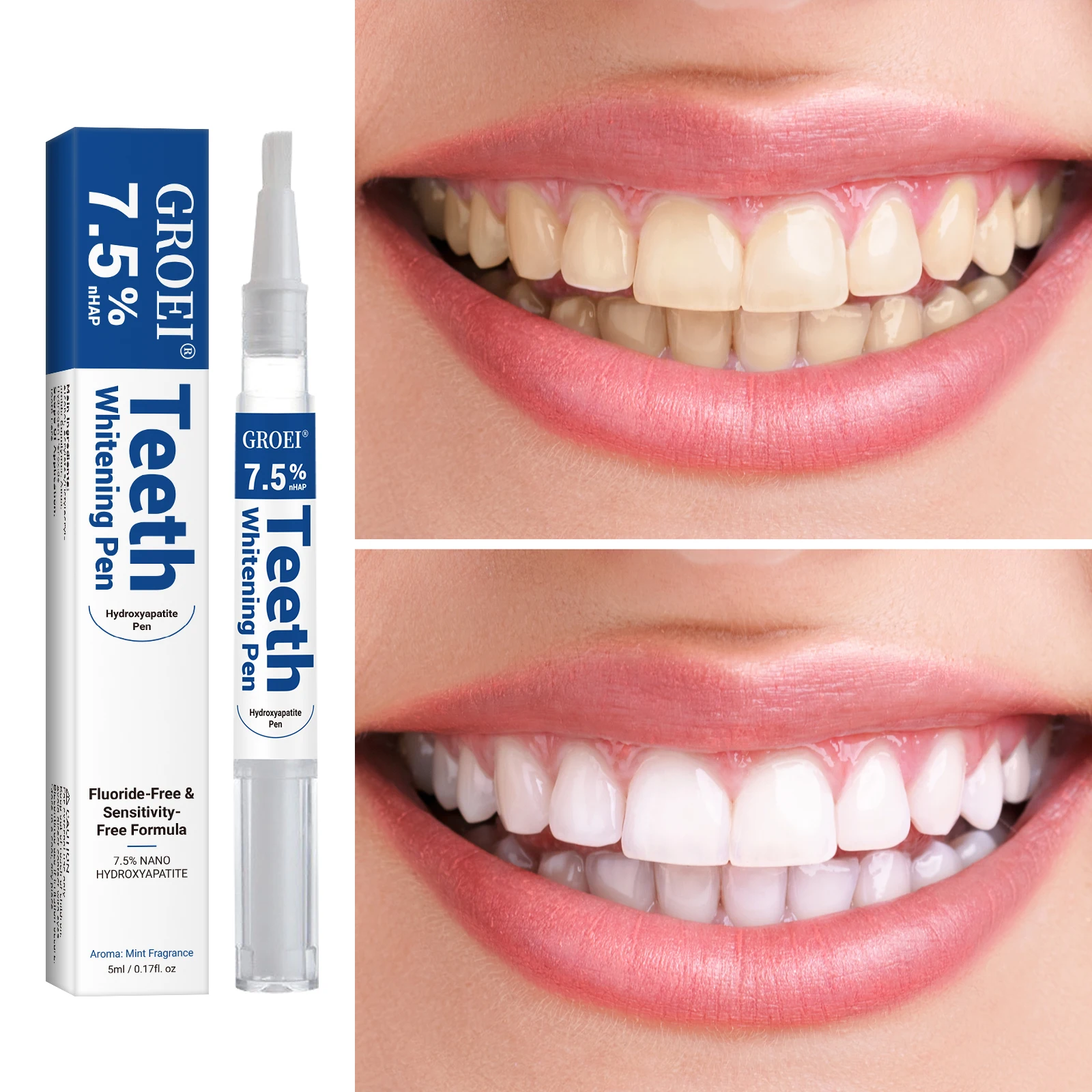 Penna per sbiancamento dei den - Teeth Whitening Before And After recensione e prezzo