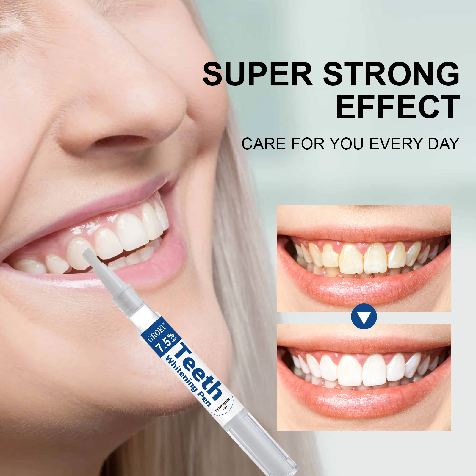 Penna per sbiancamento dei den - Teeth Whitening Before And After recensione e prezzo