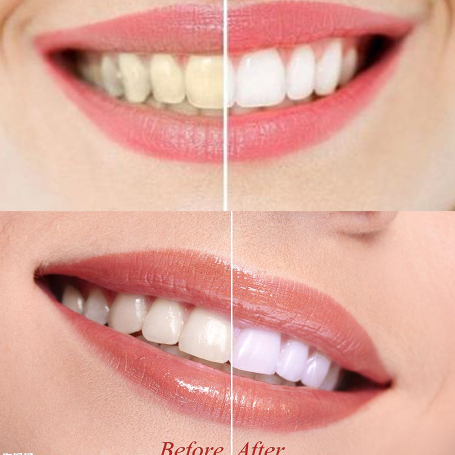 Denti di carbone di bambù dent - Teeth Whitening Levels recensione e prezzo