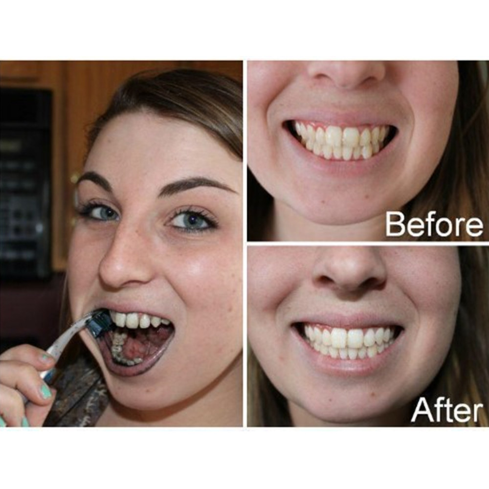 Denti di carbone di bambù dent - Teeth Whitening Levels recensione e prezzo