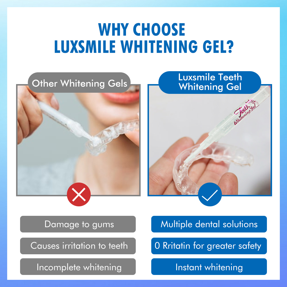 Gel sbiancante per denti PAP o - Teeth Whitening Before And After recensione e prezzo