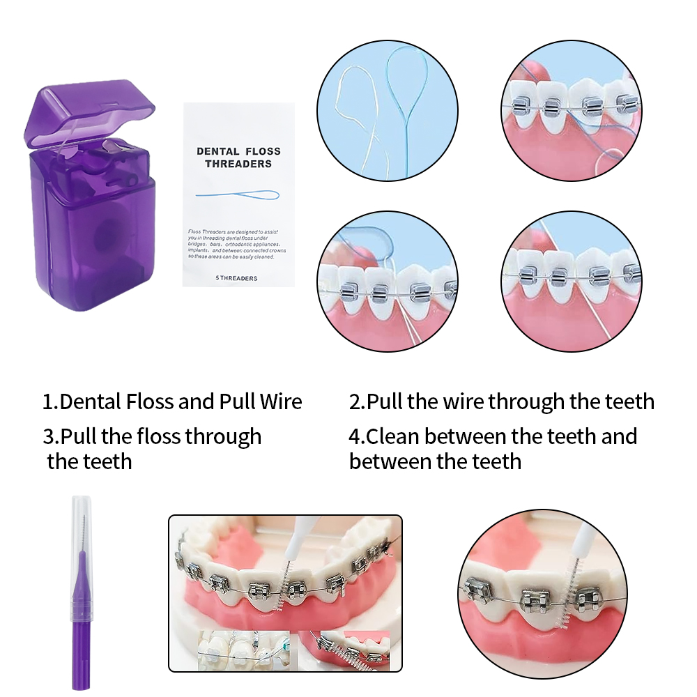 8 Pz/set Ortodontico Kit Spazz - Teeth Whitening For Braces recensione e prezzo