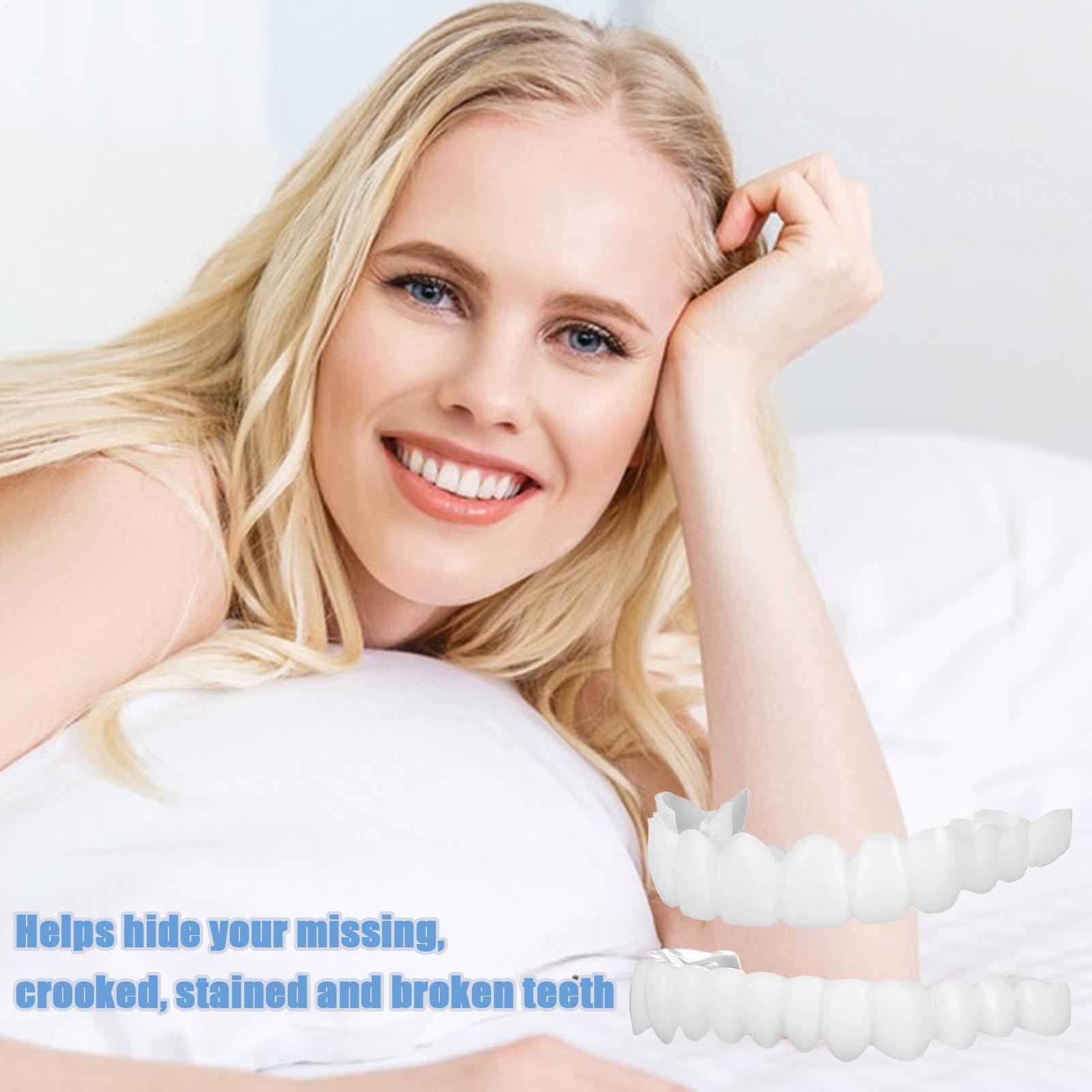 Copertura Dentale Superiore e  - Teeth Whitening For Braces recensione e prezzo