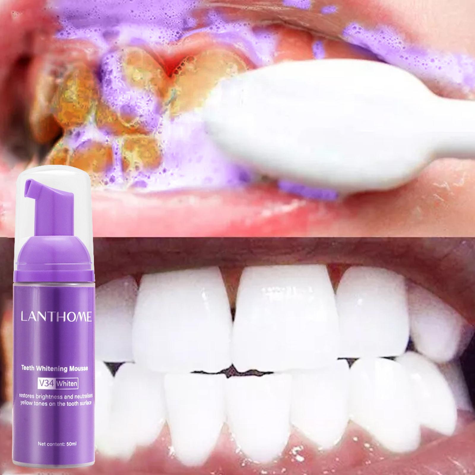 V34 Mousse Dentifricio per la  - Teeth Whitening Crest recensione e prezzo