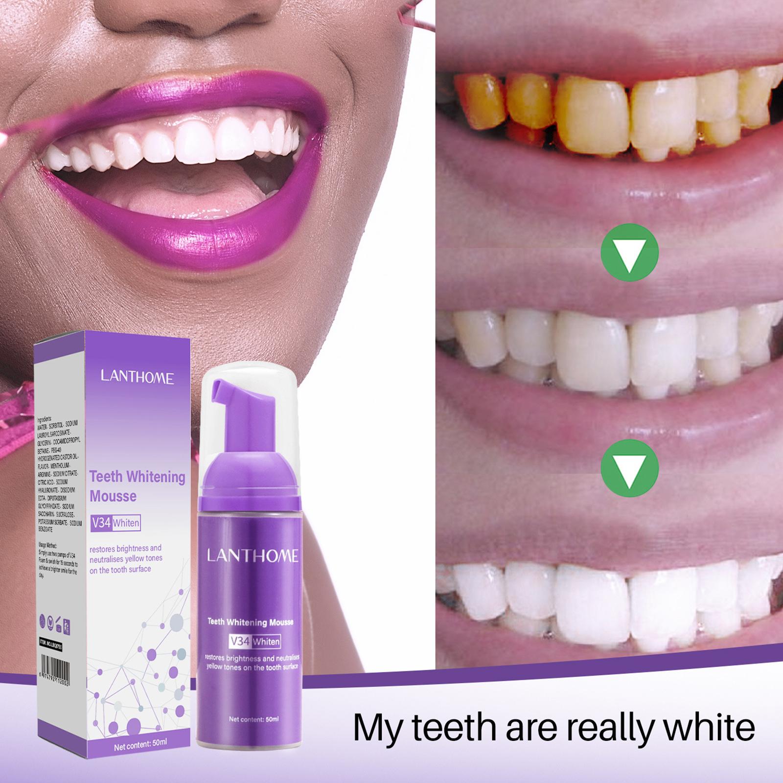 V34 Mousse Dentifricio per la  - Teeth Whitening Crest recensione e prezzo