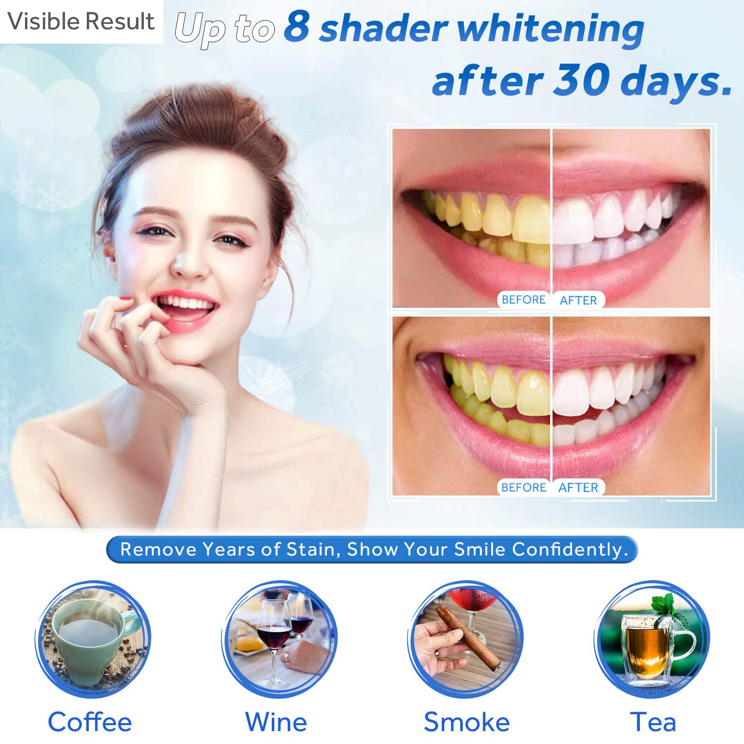 Gel sbiancante per denti Ricar - Teeth Whitening Before And After recensione e prezzo