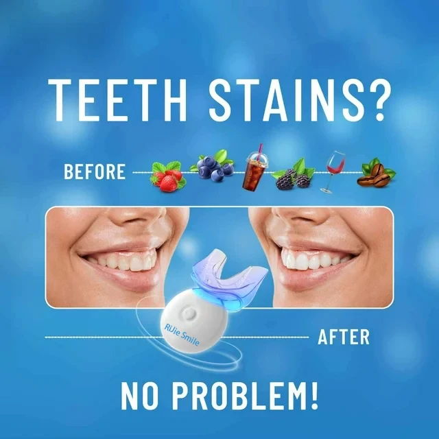 Kit di Pulizia di Alta Qualità - Teeth Whitening Kit At Home recensione e prezzo