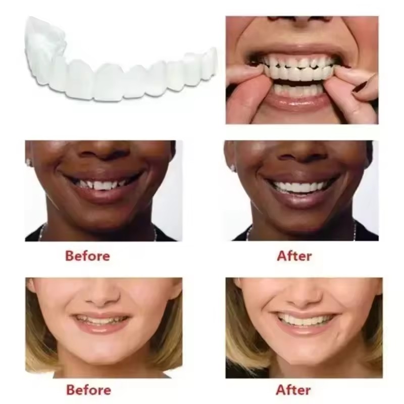 Faccette Dentali Sbiancanti, P - Teeth Whitening Vape recensione e prezzo