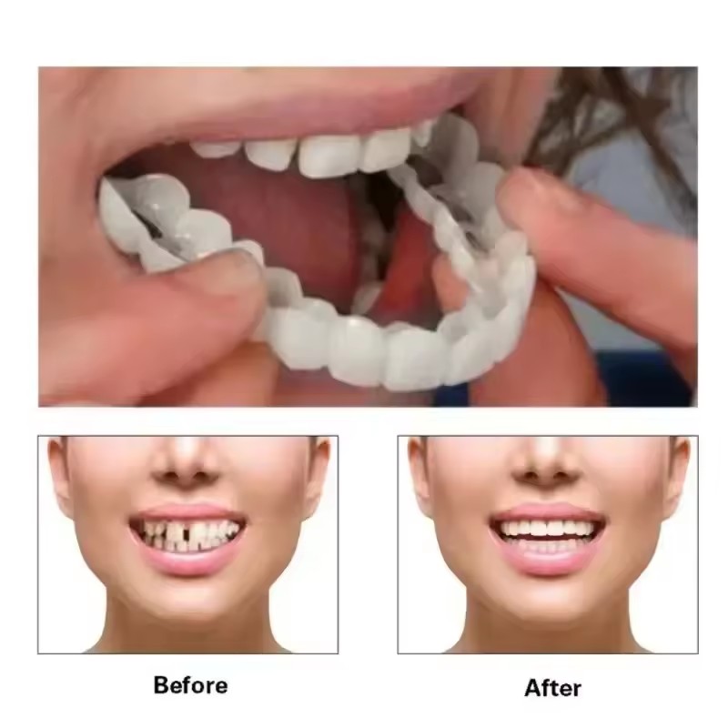 Faccette Dentali Sbiancanti, P - Teeth Whitening Vape recensione e prezzo