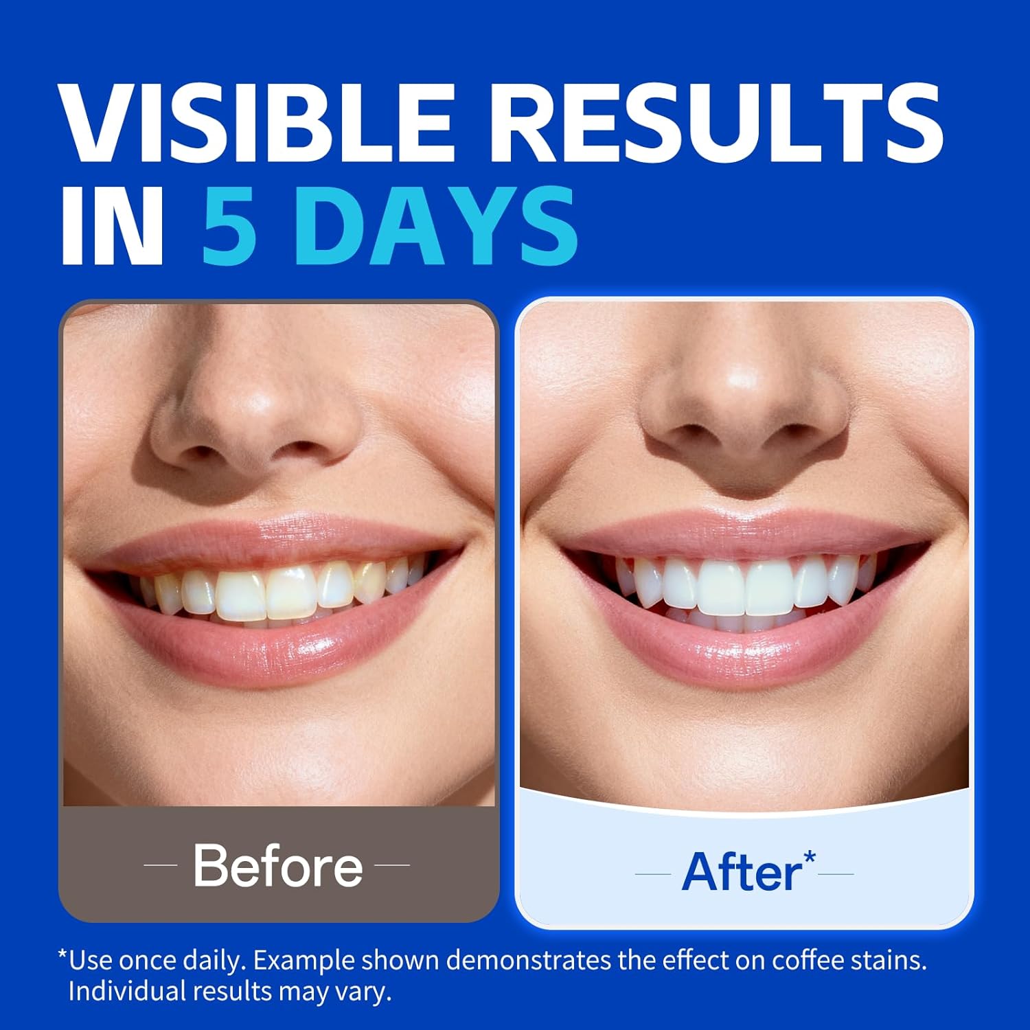 1/7 Paia di Strisce Sbiancanti - Teeth Whitening Strips Permanent recensione e prezzo