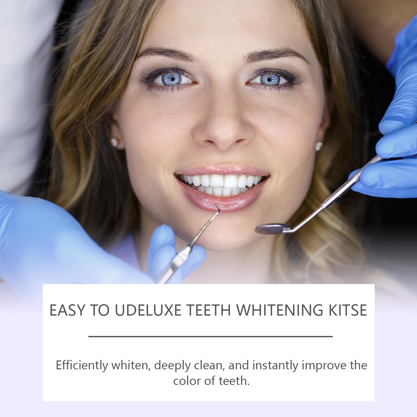 Kit Sbiancante per Denti High- - Teeth Whitening Kit At Home recensione e prezzo