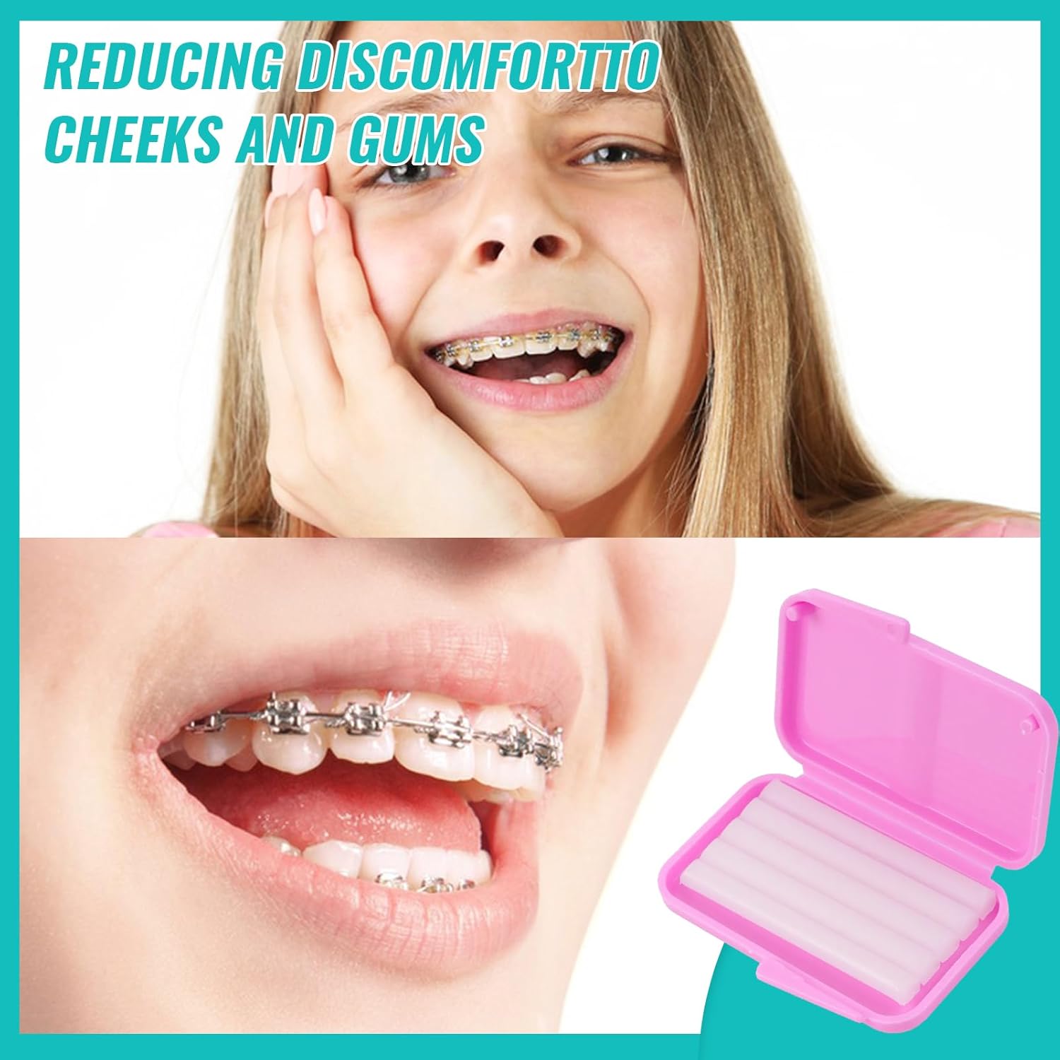 10 scatole Dentale Ortodontico - Teeth Whitening For Braces recensione e prezzo