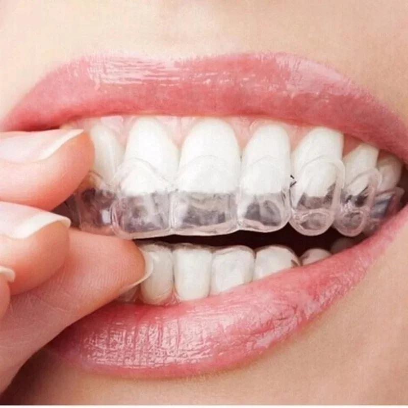 Kit Professionale per Sbiancam - Teeth Whitening Kit At Home recensione e prezzo