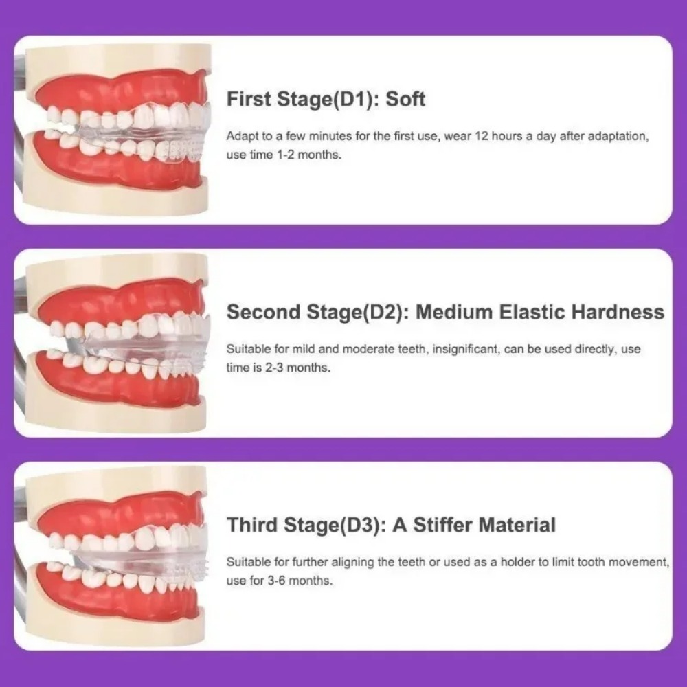 Apparecchio Ortodontico per Ra - Teeth Whitening For Braces recensione e prezzo