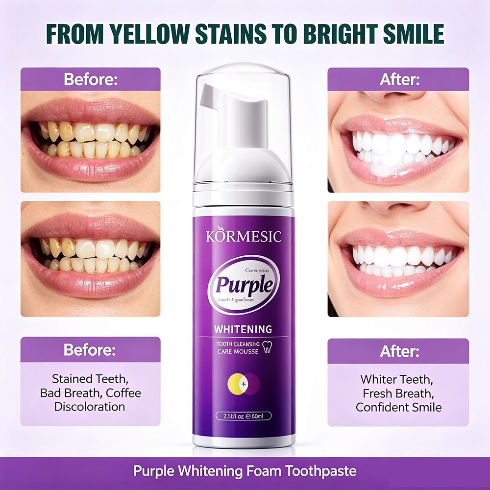Mousse sbiancante viola per de - Teeth Whitening Crest recensione e prezzo