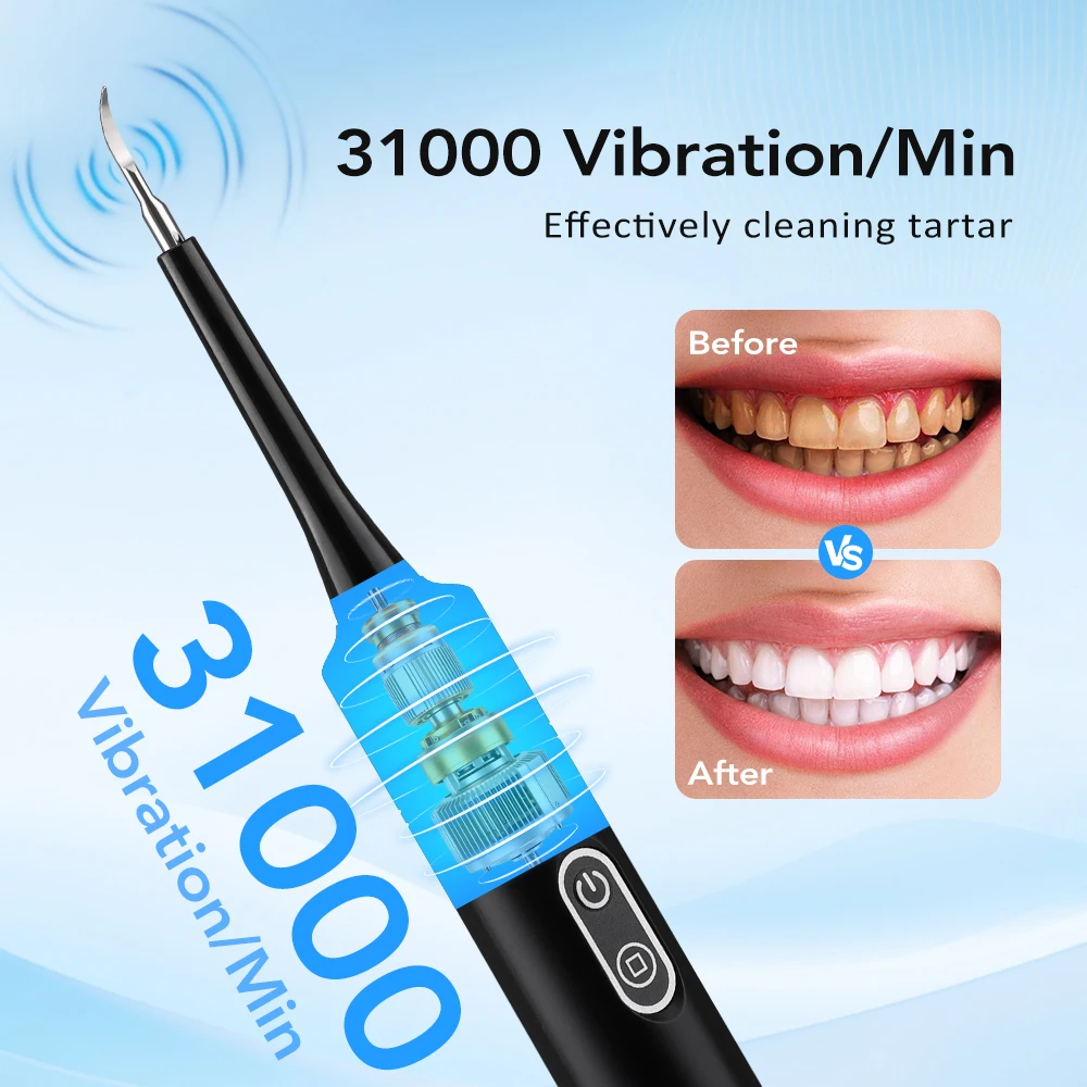 Scalatore Dentale Elettrico a  - Teeth Whitening Kit Professional recensione e prezzo